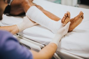 doctor helping a patient with a fractured leg